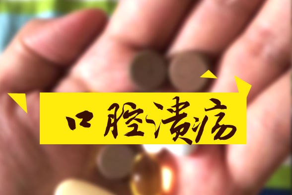 口腔潰瘍精神壓力是病因！四種小方法幫您治療口腔潰瘍