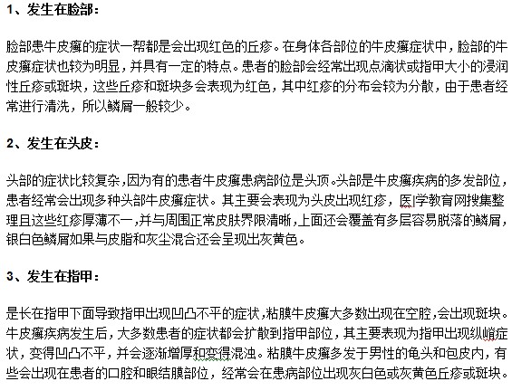 牛皮癬疾病常見的發(fā)病部位有哪些？