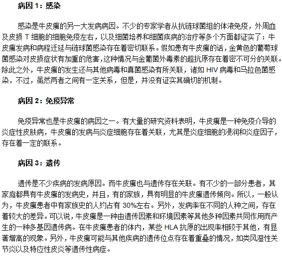 最常見的牛皮癬發(fā)病病因有什么？