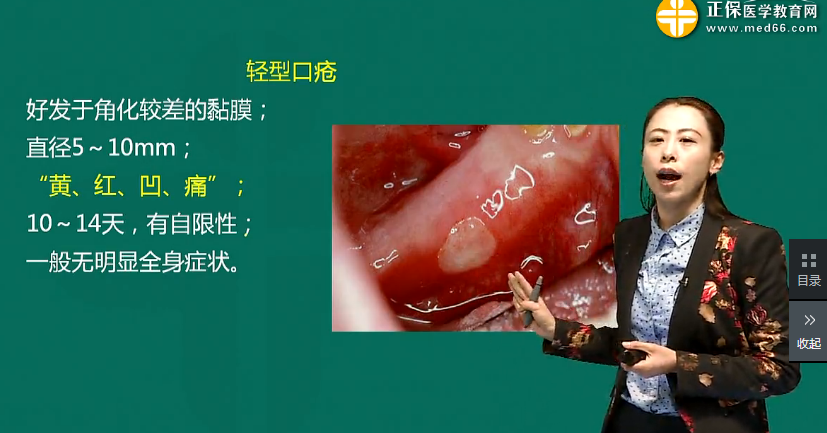 口腔內(nèi)科學復發(fā)性口腔潰瘍考點匯總